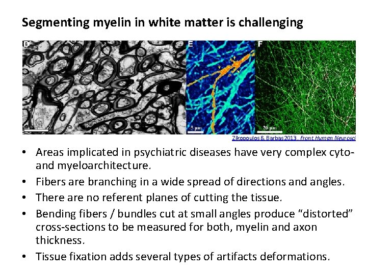 Segmenting myelin in white matter is challenging Zikopoulos & Barbas 2013, Front. Human Neurosci Segmenting myelin in white matter is challenging Zikopoulos & Barbas 2013, Front. Human Neurosci
