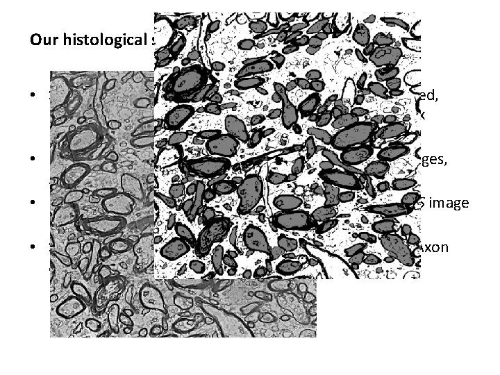 Our histological samples • Samples of human prefrontal white-matter , H&E stained, have been Our histological samples • Samples of human prefrontal white-matter , H&E stained, have been