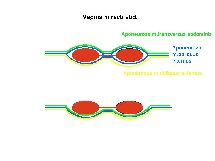 Vagina m. recti abd. Aponeuroza m. transversus abdominis Aponeuroza m. obliquus internus Aponeuroza m.