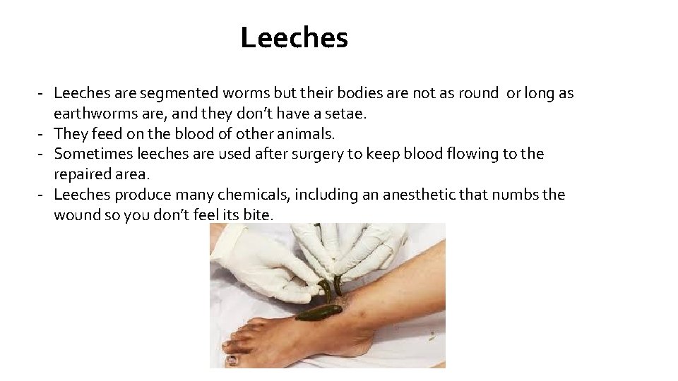 Leeches - Leeches are segmented worms but their bodies are not as round or