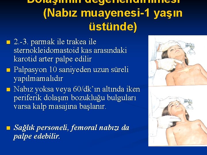 Dolaşımın değerlendirilmesi (Nabız muayenesi-1 yaşın üstünde) n n 2. -3. parmak ile trakea ile