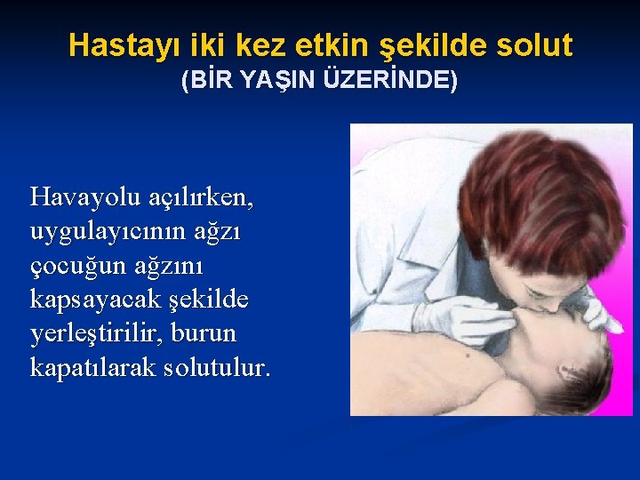 Hastayı iki kez etkin şekilde solut (BİR YAŞIN ÜZERİNDE) Havayolu açılırken, uygulayıcının ağzı çocuğun