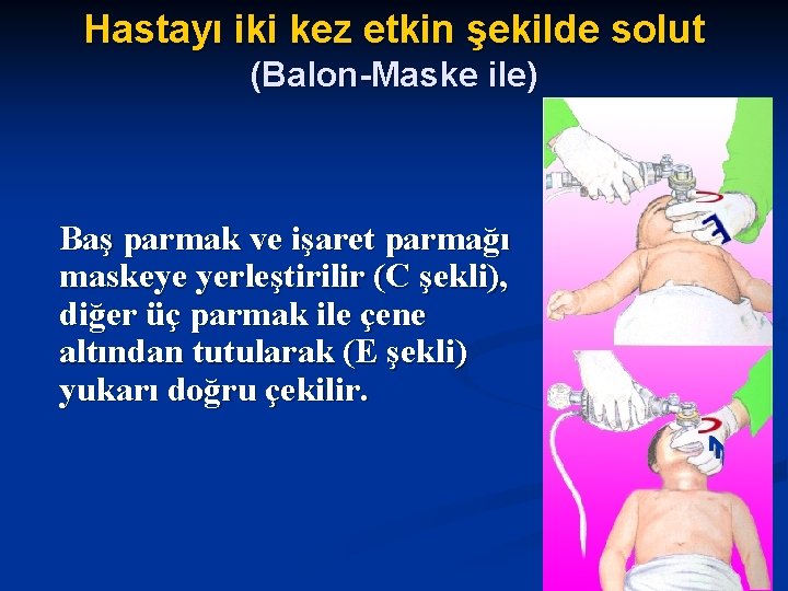 Hastayı iki kez etkin şekilde solut (Balon-Maske ile) Baş parmak ve işaret parmağı maskeye