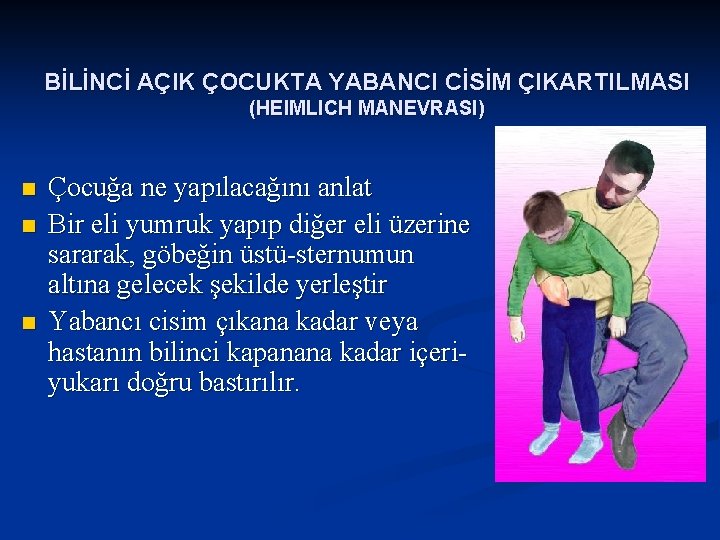 BİLİNCİ AÇIK ÇOCUKTA YABANCI CİSİM ÇIKARTILMASI (HEIMLICH MANEVRASI) n n n Çocuğa ne yapılacağını