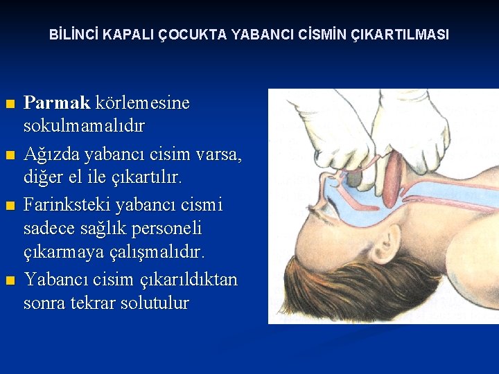 BİLİNCİ KAPALI ÇOCUKTA YABANCI CİSMİN ÇIKARTILMASI n n Parmak körlemesine sokulmamalıdır Ağızda yabancı cisim