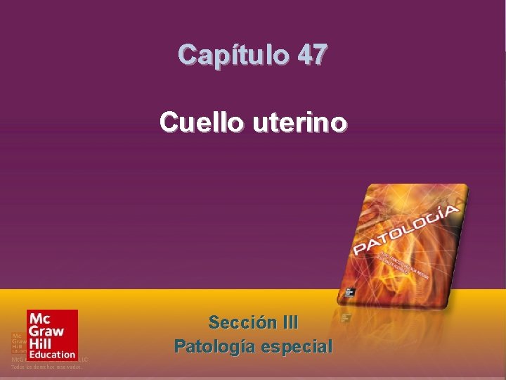 Sección III. Patología especial Capítulo 47. Cuello uterino Capítulo 47 Cuello uterino Mc. Graw-Hill Sección III. Patología especial Capítulo 47. Cuello uterino Capítulo 47 Cuello uterino Mc. Graw-Hill