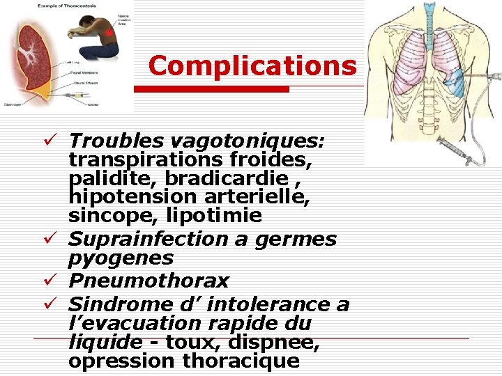 Complications ü Troubles vagotoniques: transpirations froides, palidite, bradicardie , hipotension arterielle, sincope, lipotimie ü