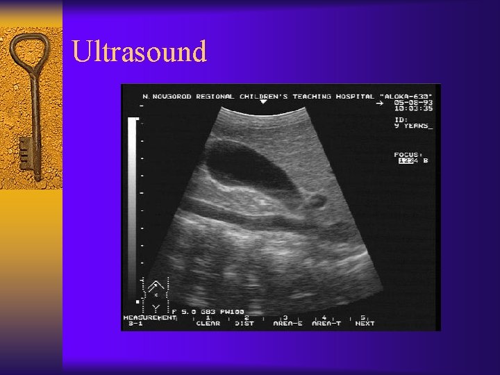 Ultrasound 