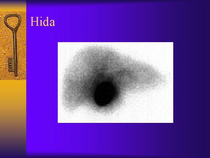 Hida 