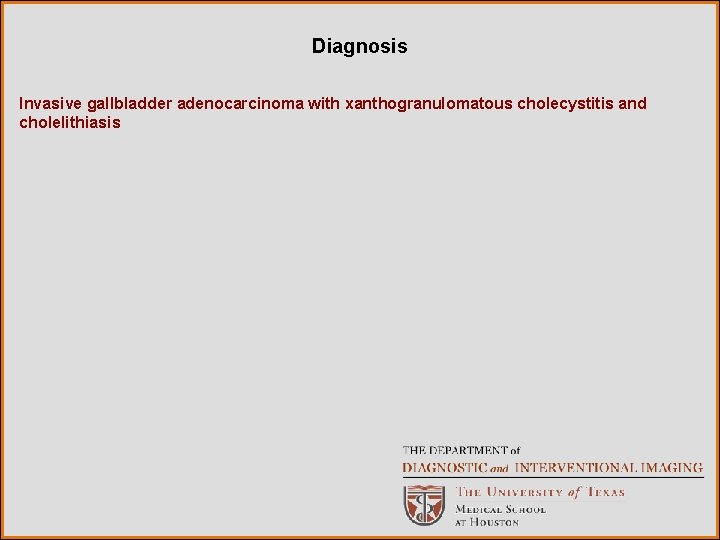 Diagnosis Invasive gallbladder adenocarcinoma with xanthogranulomatous cholecystitis and cholelithiasis 
