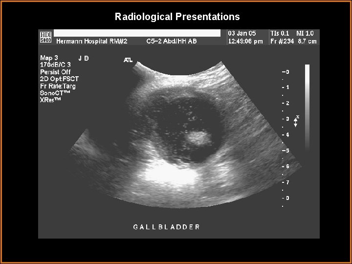 Radiological Presentations 