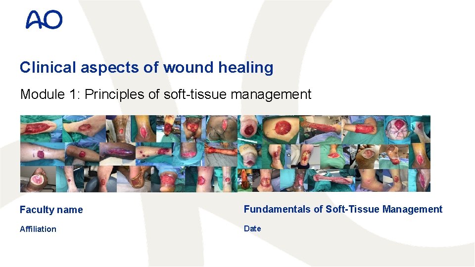 Clinical aspects of wound healing Module 1: Principles of soft-tissue management Faculty name Fundamentals