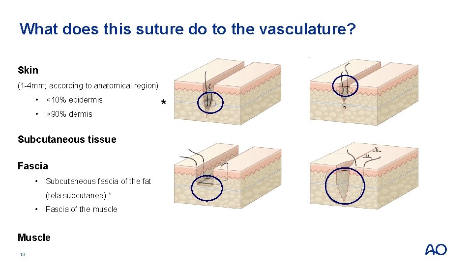 What does this suture do to the vasculature? Skin (1 -4 mm; according to