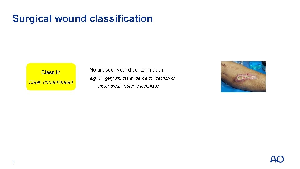 Surgical wound classification Class I: Clean Class II: Clean contaminated 7 Uninfected wounds without