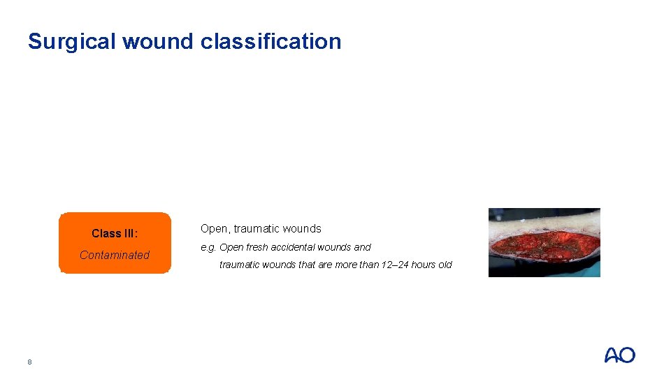 Surgical wound classification Class I: Clean Class II: Clean contaminated Class III: Contaminated 8