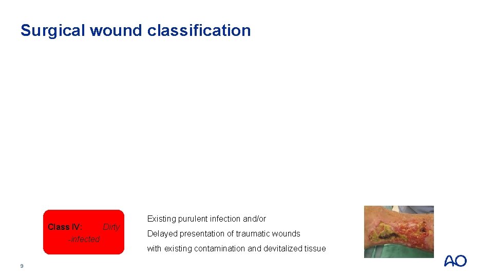 Surgical wound classification Class I: Clean Class II: Clean contaminated Class III: Contaminated Class