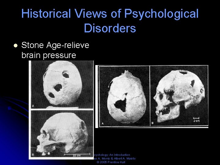 Historical Views of Psychological Disorders l Stone Age-relieve brain pressure Psychology: An Introduction Charles