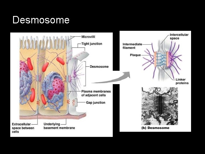 Desmosome 