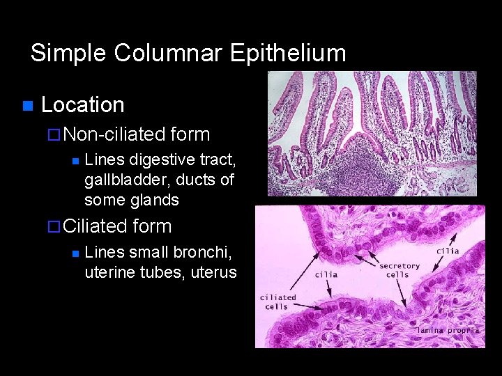 Simple Columnar Epithelium n Location ¨ Non-ciliated n Lines digestive tract, gallbladder, ducts of Simple Columnar Epithelium n Location ¨ Non-ciliated n Lines digestive tract, gallbladder, ducts of
