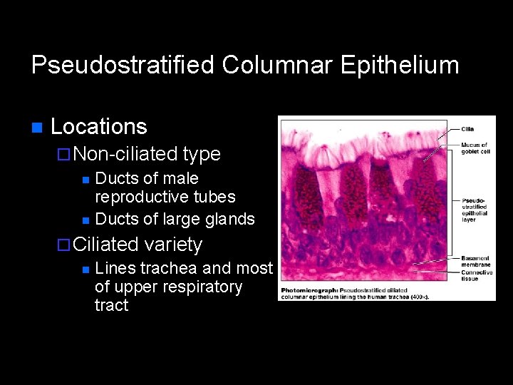 Pseudostratified Columnar Epithelium n Locations ¨ Non-ciliated type n Ducts of male reproductive tubes