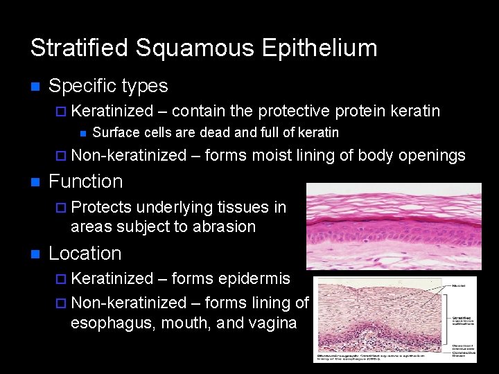 Stratified Squamous Epithelium n Specific types ¨ Keratinized n – contain the protective protein