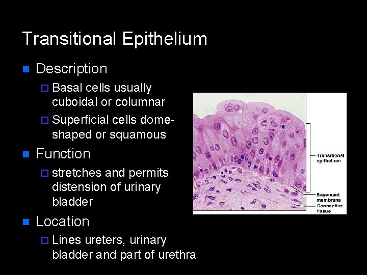 Transitional Epithelium n Description ¨ Basal cells usually cuboidal or columnar ¨ Superficial cells