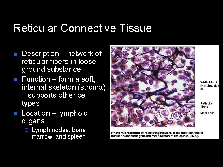 Reticular Connective Tissue n n n Description – network of reticular fibers in loose