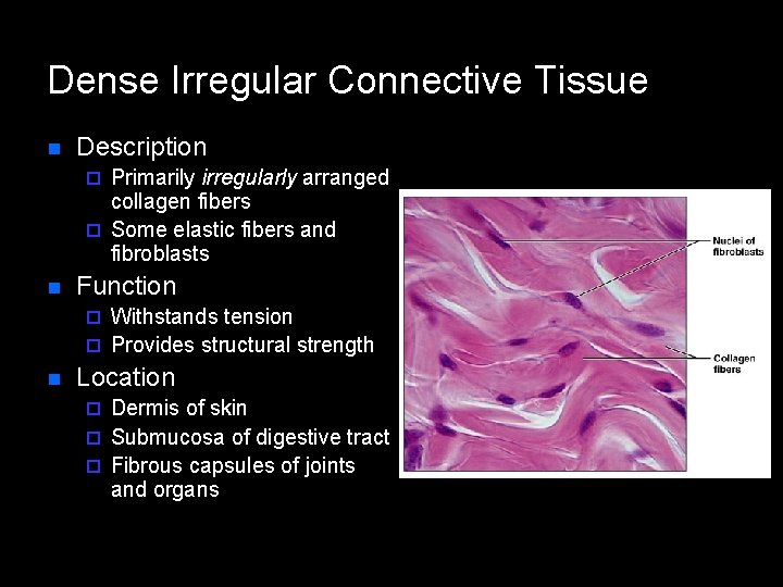 Dense Irregular Connective Tissue n Description Primarily irregularly arranged collagen fibers ¨ Some elastic