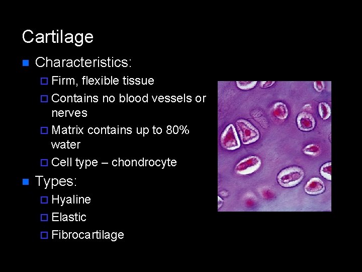 Cartilage n Characteristics: ¨ Firm, flexible tissue ¨ Contains no blood vessels or nerves