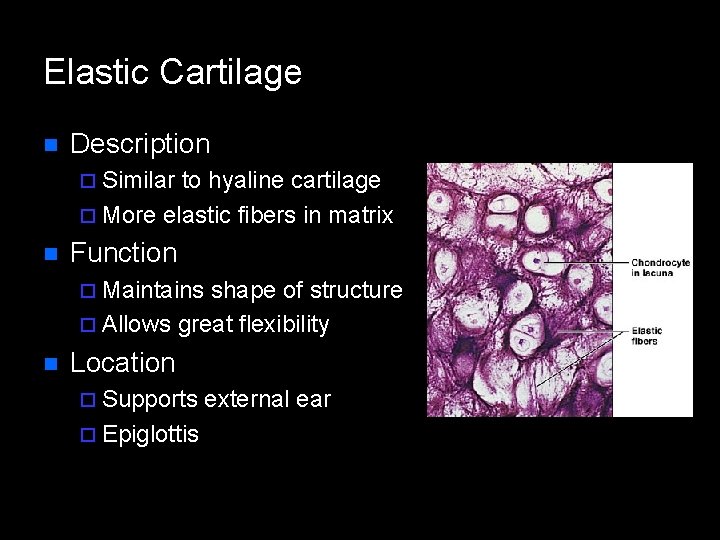 Elastic Cartilage n Description ¨ Similar to hyaline cartilage ¨ More elastic fibers in