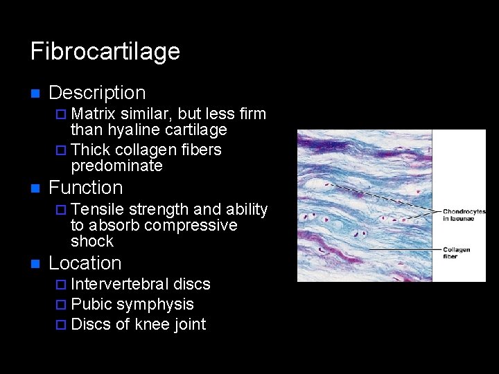 Fibrocartilage n Description ¨ Matrix similar, but less firm than hyaline cartilage ¨ Thick