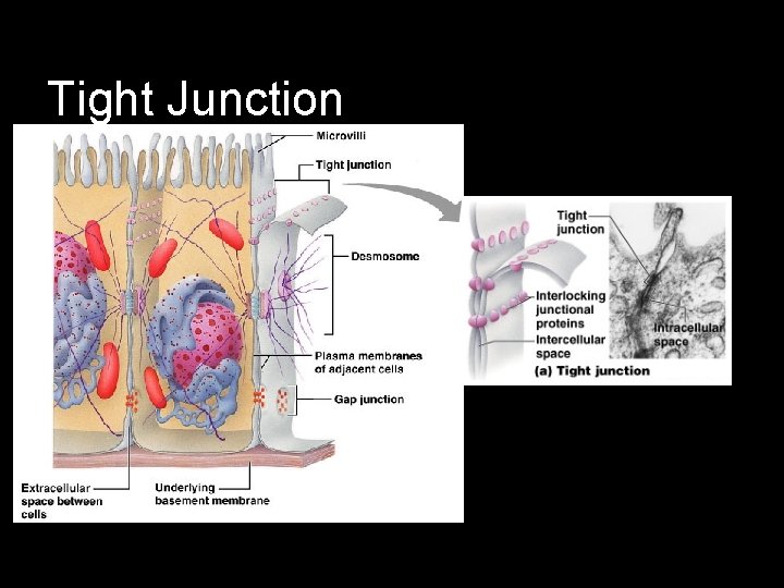 Tight Junction 