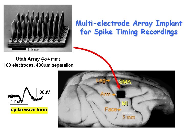 Multi-electrode Array Implant for Spike Timing Recordings Utah Array (4 x 4 mm) 100