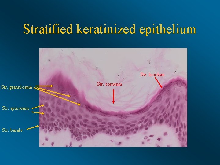 Stratified keratinized epithelium Str. lucidum Str. granulosum Str. spinosum Str. basale Str. corneum 