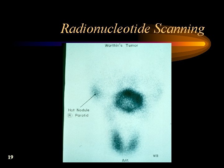 Radionucleotide Scanning 19 
