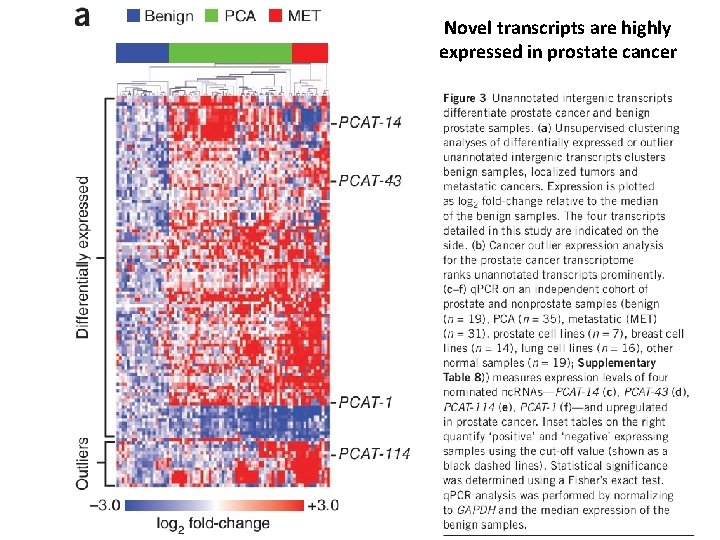 Novel transcripts are highly expressed in prostate cancer 