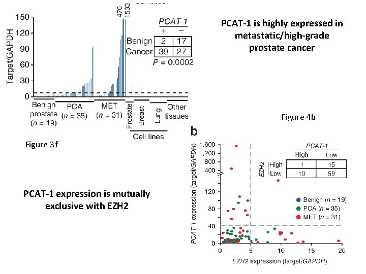 PCAT-1 is highly expressed in metastatic/high-grade prostate cancer Figure 4 b Figure 3 f