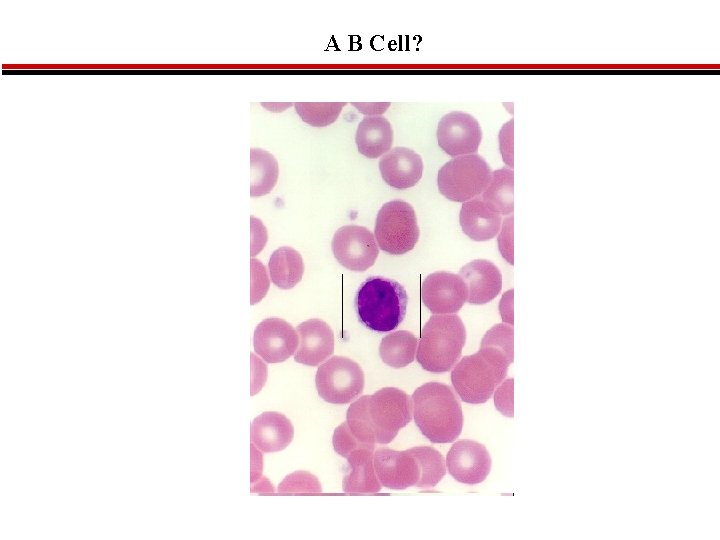 A B Cell? 