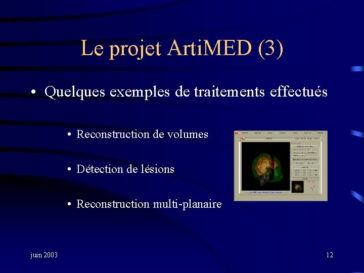 Le projet Arti. MED (3) • Quelques exemples de traitements effectués • Reconstruction de