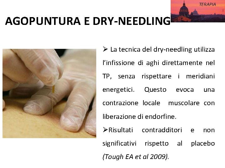 TERAPIA AGOPUNTURA E DRY-NEEDLING Ø La tecnica del dry-needling utilizza l’infissione di aghi direttamente