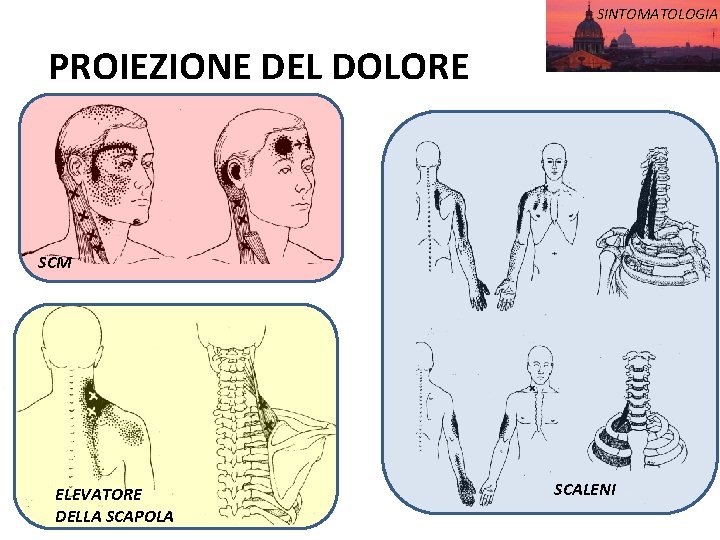 SINTOMATOLOGIA PROIEZIONE DEL DOLORE SCM ELEVATORE DELLA SCAPOLA SCALENI 