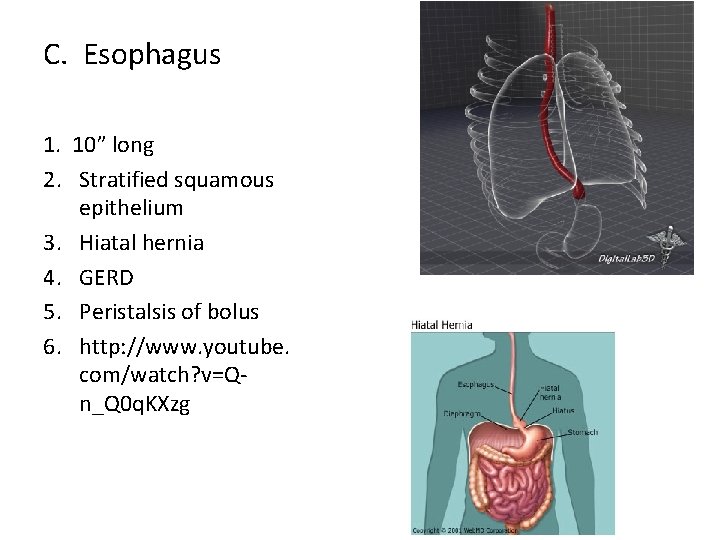 C. Esophagus 1. 10” long 2. Stratified squamous epithelium 3. Hiatal hernia 4. GERD
