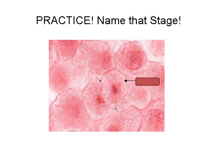 PRACTICE! Name that Stage! 