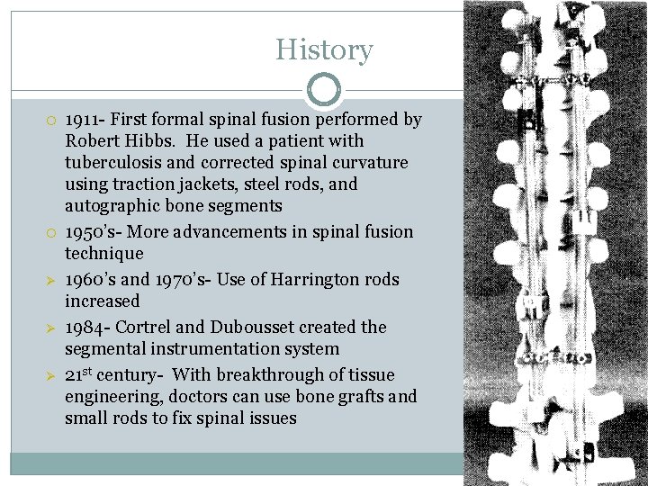 History Ø Ø Ø 1911 - First formal spinal fusion performed by Robert Hibbs.