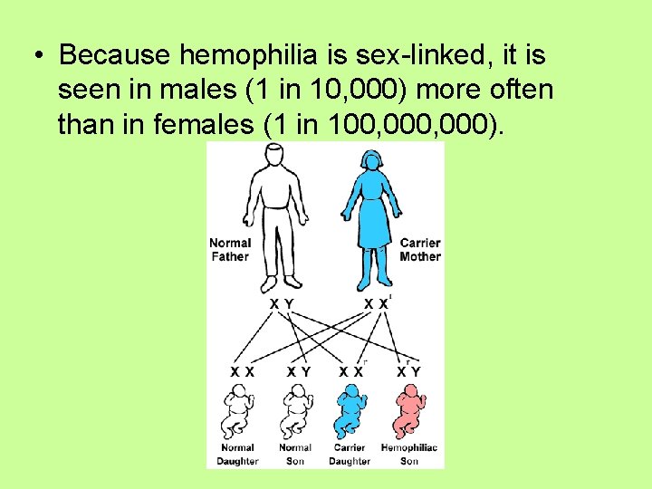  • Because hemophilia is sex-linked, it is seen in males (1 in 10,