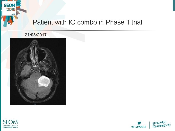 Patient with IO combo in Phase 1 trial 21/03/2017 #SEOM 2018 
