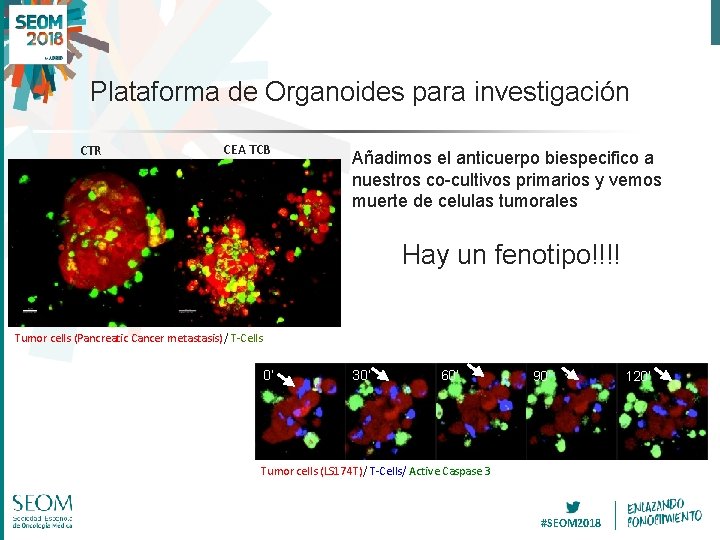 Plataforma de Organoides para investigación CTR CEA TCB Añadimos el anticuerpo biespecifico a nuestros