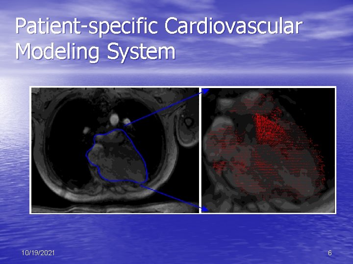 Patient-specific Cardiovascular Modeling System 10/19/2021 6 