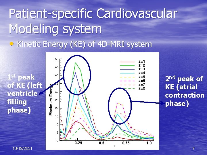 Patient-specific Cardiovascular Modeling system • Kinetic Energy (KE) of 4 D-MRI system 1 st