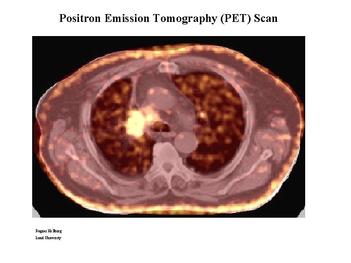 Positron Emission Tomography (PET) Scan Ragnar Hellborg Lund University 